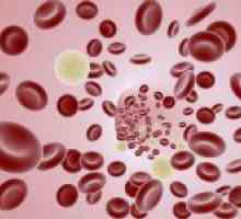 Důvody a způsoby léčení nízkého krevního leukocytů