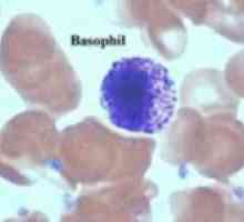 Důvody pro zvýšení bazofilů v krvi dospělých