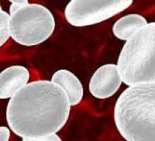 Důvody pro zvýšení krevních monocytech