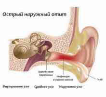 Příčiny těchto příznaků a léčba zánětu středního ucha do ucha