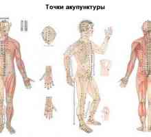 Použití akupunktury