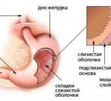 Příznaky onemocnění žaludku