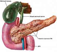 Známky a příznaky pankreatitidy u žen