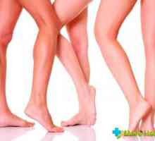 Příznaky křečových žilách nohou: Jak tomu zabránit?