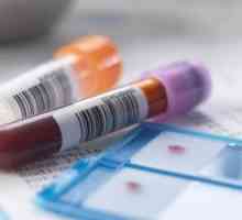 Rozluštění biochemickou analýzu krevních parametrů u dětí