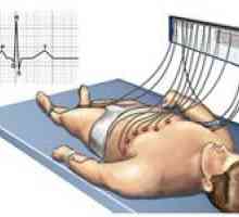 Dešifrovat diagnostických měření EKG sám