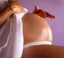Účinnost olivového oleje na strie během těhotenství a způsoby jejich použití