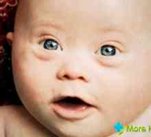 Vývoj dětí s Downovým syndromem: charakteristik a odlišností od normálního dítěte
