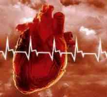 Resuscitace srdeční zástava - to, co potřebujete vědět a umět