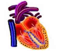 Restriktivní kardiomyopatie, a zejména jejich léčba