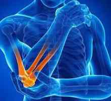 Revmatoidní artritida. Léčba lidových prostředků