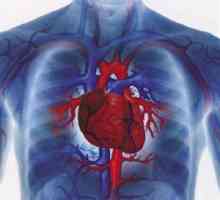 Kardiovaskulární onemocnění - zejména pro jejich zpracování a úmrtnost ve východní Evropě