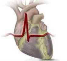 Revmatické srdeční