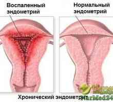 Síla bylin v léčbě endometritidy