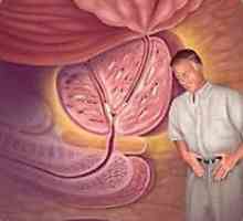 Příznaků benigní hyperplazie prostaty