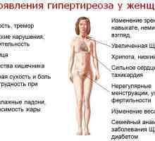 Symptomy a příznaky hypertyreózy u žen