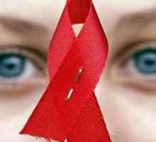 Příznaky HIV