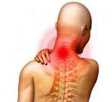 Syndrom vertebrální tepny: definice, příznaky, léčba, rizikové skupiny