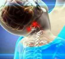 Syndrom vertebrální tepny