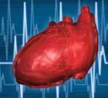 Syndrom předčasného repolarizaci srdečních komor