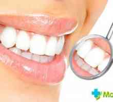 Kolik je bělení zubů u zubaře: druhy a náklady na bělení