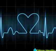 Slabé srdce - příležitost k návštěvě kardiolog