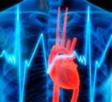 Stabilní angina: jeho funkční třídy a léčba