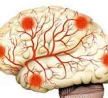 Jaké nástroje jsou nejvhodnější pro posílení krevních cév v mozku?