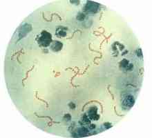 Streptococcus. Streptococcus detekován v nosu, hrtanu, hltanu, kůže, co mám dělat? Streptococcus u…