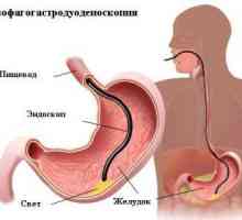 Postup gastroskopie žaludek