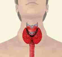 Thyrotoxic struma