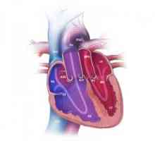 Transpozice velkých cév: podstatou UPU, příčiny, léčba, prognóza