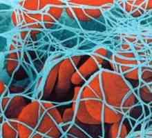 Trombofilie: Vznik genetické složky, typy, léčba, rizika