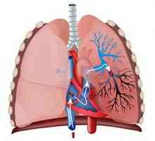 Plicní embolie (PE): příčiny, příznaky, léčba