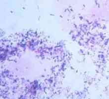 Ureaplasma urealitikum (Ureaplasma urealyticum): co to je a co dělat, když je zjištěna infekce v…