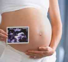 Uzi během těhotenství - dítěte pohlaví: co týden a první příznaky pohlaví