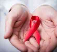 HIV infekce: příznaky u mužů, léčba