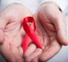 HIV infekce: příznaky u žen a prognóza po ošetření