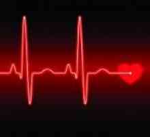 Příznaky a diagnostika srdečních arytmií