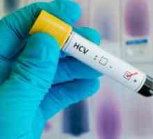 Virová zátěž v hepatitidy s: typy testů a interpretace výsledků