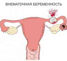 Mimoděložní těhotenství v časných stádiích: příznaky a symptomy