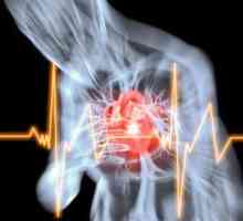 Náhlá smrt srdeční způsobuje akutní koronární nedostatečnosti a další