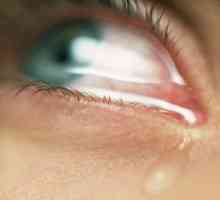 Zánět očí, očních víček (blefaritida), slzení. Léčba lidových prostředků.