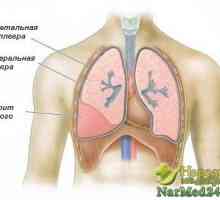 Výskyt zánět pohrudnice plic a její léčba lidových opravné