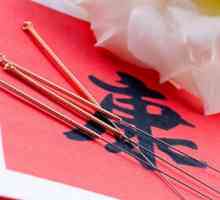 Vše o akupunktura: konkrétní použití v neuralgie