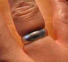 Všechny metody odstraňování prsten s oteklý prst