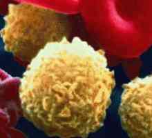 Vysoký krevní leukocyty