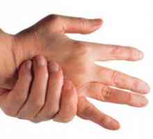 Vykloubení palce: Léčba doma
