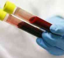 Klíčové ukazatele leukocytů krve vzorce a její interpretace