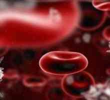 Krevní poruchy: seznam nejčastějších a nejzávažnějších chorob